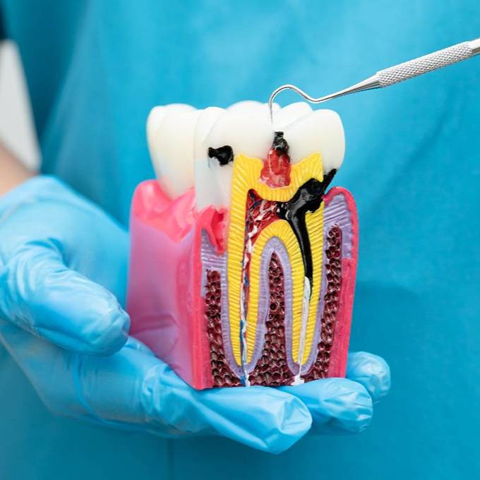 Endodoncia